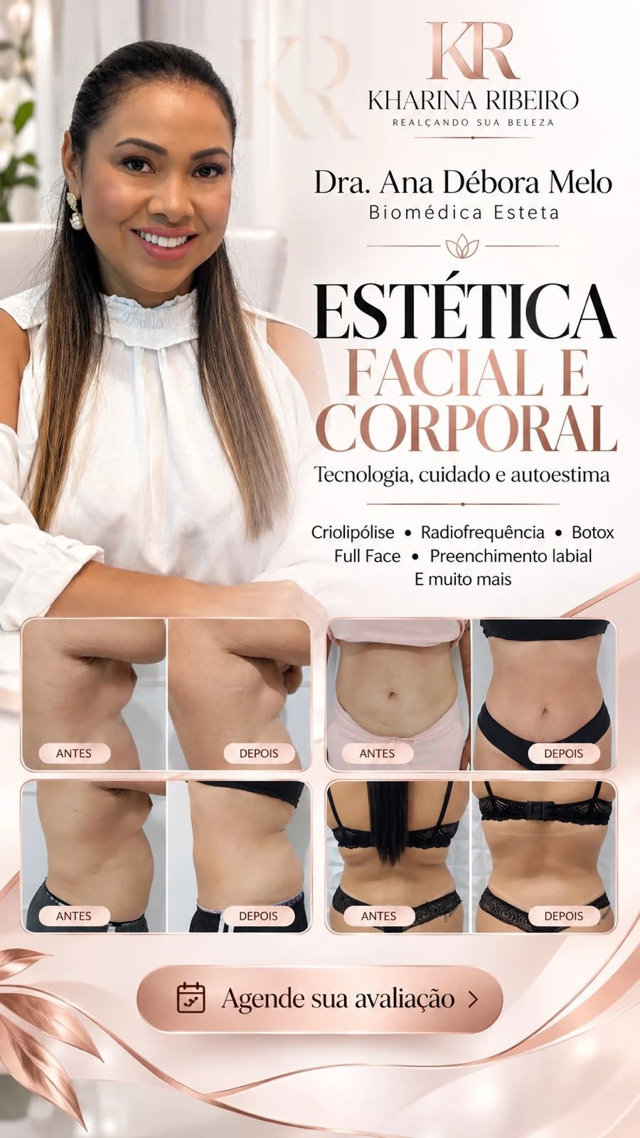 Anúncio do Salão Kharina Ribeiro: Estética facial e corporal com a Dra. Ana Débora Melo